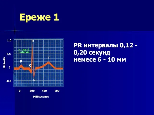 Ереже 1 Millivolts Milliseconds 0 200 400 600 -0.5 0 0.5 1.0