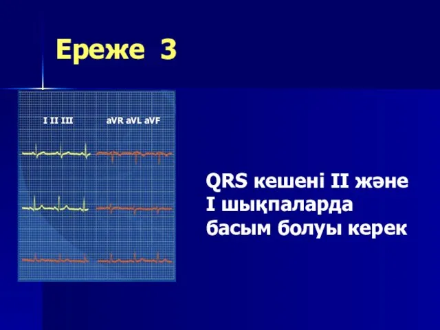 Ереже 3 QRS кешені II және I шықпаларда басым болуы керек