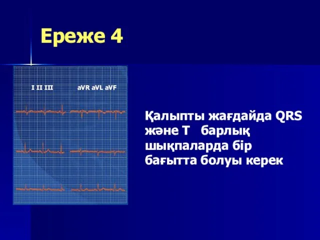 Ереже 4 Қалыпты жағдайда QRS және T барлық шықпаларда бір бағытта болуы керек