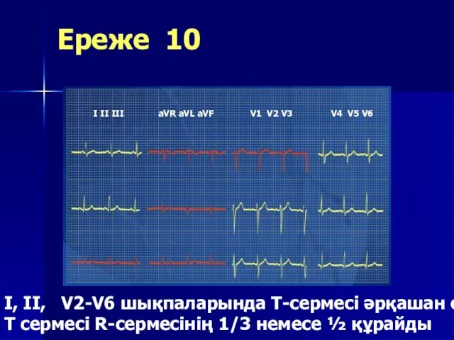 Ереже 10 I, II, V2-V6 шықпаларында Т-сермесі әрқашан оң, Т сермесі R-сермесінің 1/3 немесе ½ құрайды