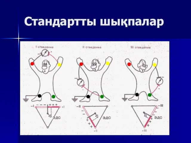 Стандартты шықпалар