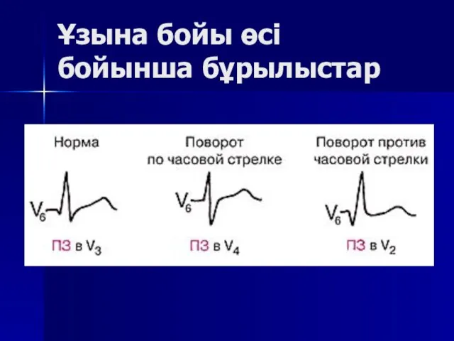 Ұзына бойы өсі бойынша бұрылыстар