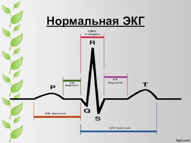 Нормальная ЭКГ