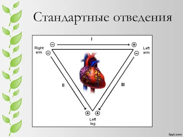 Стандартные отведения