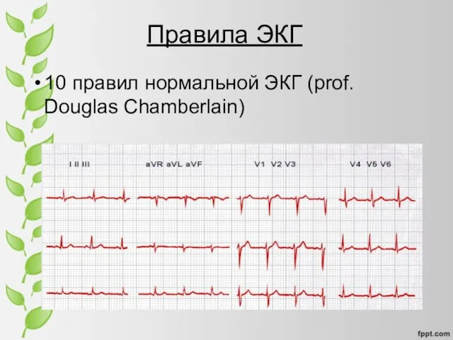 Правила ЭКГ 10 правил нормальной ЭКГ (prof. Douglas Chamberlain)