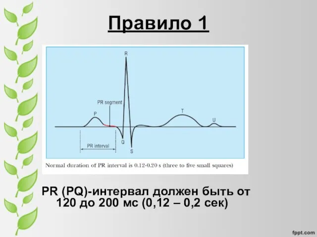 Правило 1 PR (PQ)-интервал должен быть от 120 до 200 мс (0,12 – 0,2 сек)