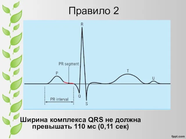 Правило 2 Ширина комплекса QRS не должна превышать 110 мс (0,11 сек)