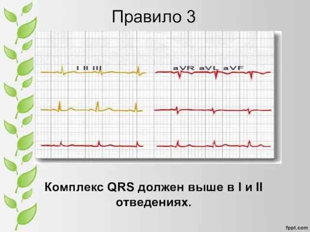 Правило 3 Комплекс QRS должен выше в I и II отведениях.