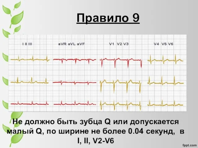 Правило 9 Не должно быть зубца Q или допускается малый Q, по