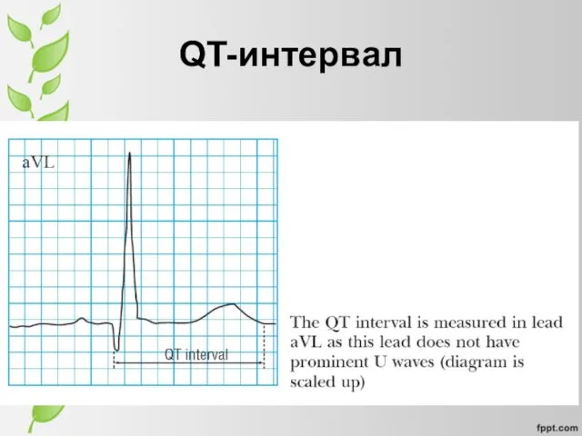 QT-интервал