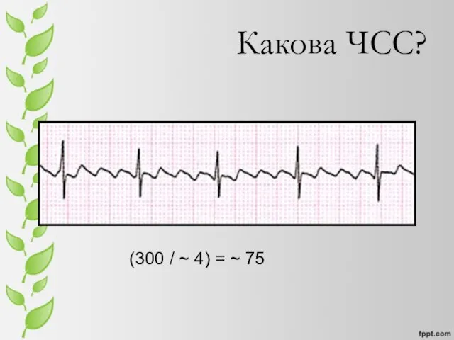 Какова ЧСС? (300 / ~ 4) = ~ 75