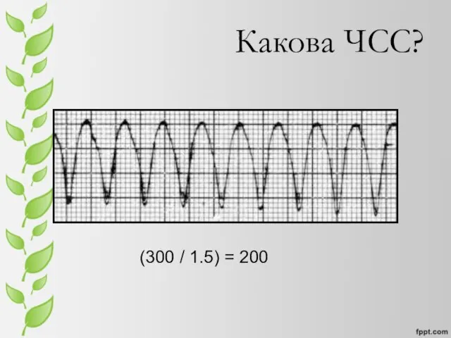 Какова ЧСС? (300 / 1.5) = 200