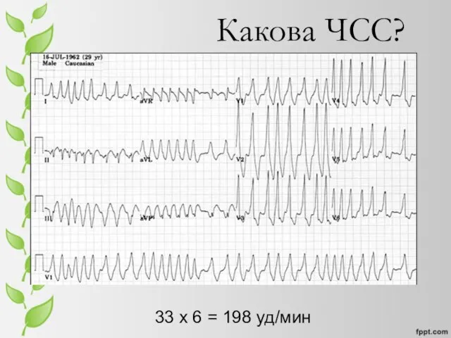 Какова ЧСС? 33 x 6 = 198 уд/мин