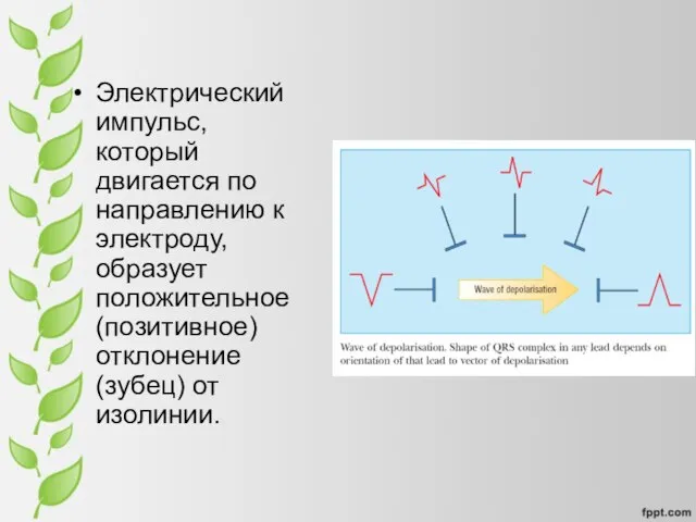 Электрический импульс, который двигается по направлению к электроду, образует положительное (позитивное) отклонение (зубец) от изолинии.