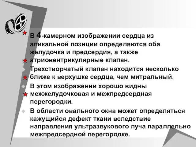 В 4-камерном изображении сердца из апикальной позиции определяются оба желудочка и предсердия,