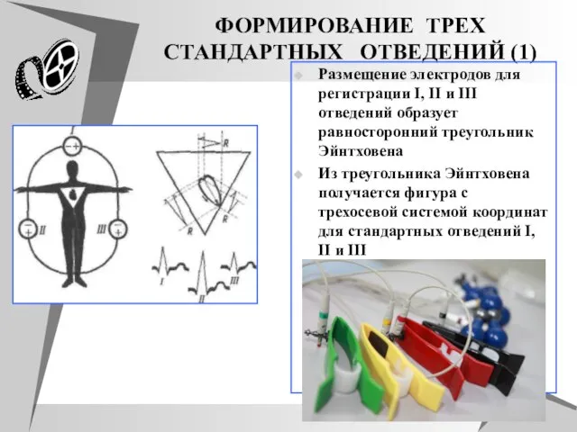 ФОРМИРОВАНИЕ ТРЕХ СТАНДАРТНЫХ ОТВЕДЕНИЙ (1) Размещение электродов для регистрации I, II и