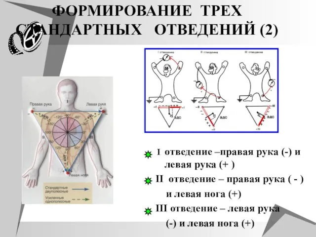 ФОРМИРОВАНИЕ ТРЕХ СТАНДАРТНЫХ ОТВЕДЕНИЙ (2) I отведение –правая рука (-) и левая