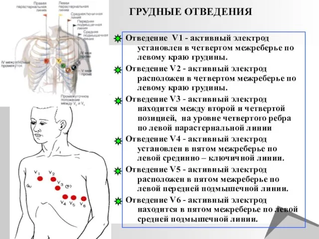 ГРУДНЫЕ ОТВЕДЕНИЯ Отведение V1 - активный электрод установлен в четвертом межреберье по