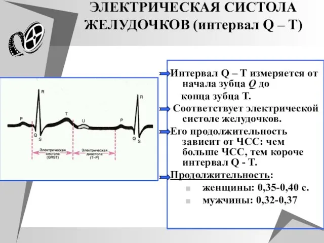 ЭЛЕКТРИЧЕСКАЯ СИСТОЛА ЖЕЛУДОЧКОВ (интервал Q – T) Интервал Q – T измеряется