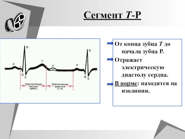 Сегмент T-P От конца зубца T до начала зубца P. Отражает электрическую