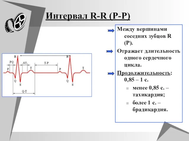 Интервал R-R (P-P) Между вершинами соседних зубцов R (P). Отражает длительность одного