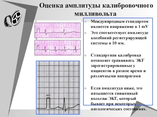 Оценка амплитуды калибровочного милливольта Международным стандартом является напряжение в 1 mV Это