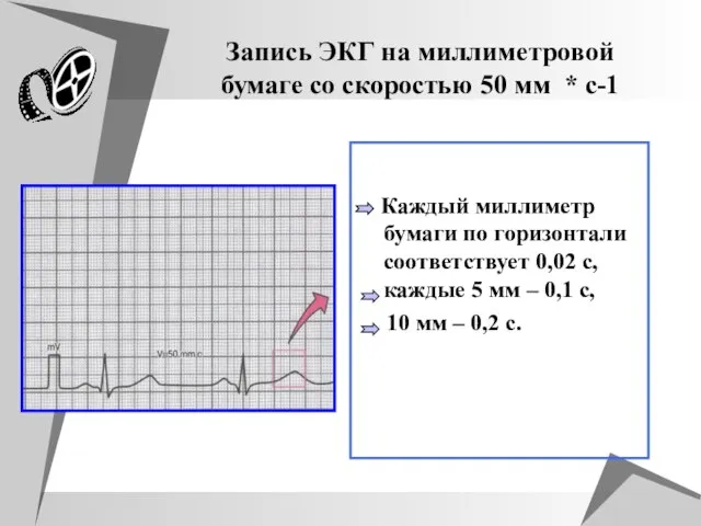 Запись ЭКГ на миллиметровой бумаге со скоростью 50 мм * с-1 Каждый