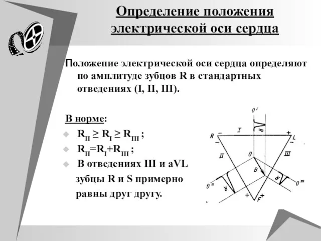 Определение положения электрической оси сердца Положение электрической оси сердца определяют по амплитуде