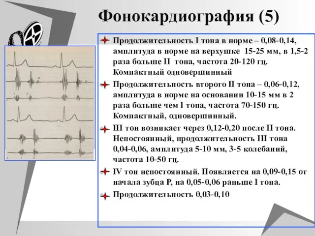 Фонокардиография (5) Продолжительность I тона в норме – 0,08-0,14, амплитуда в норме