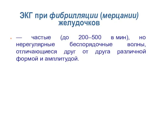 ЭКГ при фибрилляции (мерцании) желудочков — частые (до 200–500 в мин), но