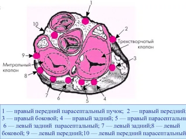 1 — правый передний парасептальный пучок; 2 — правый передний; 3 —