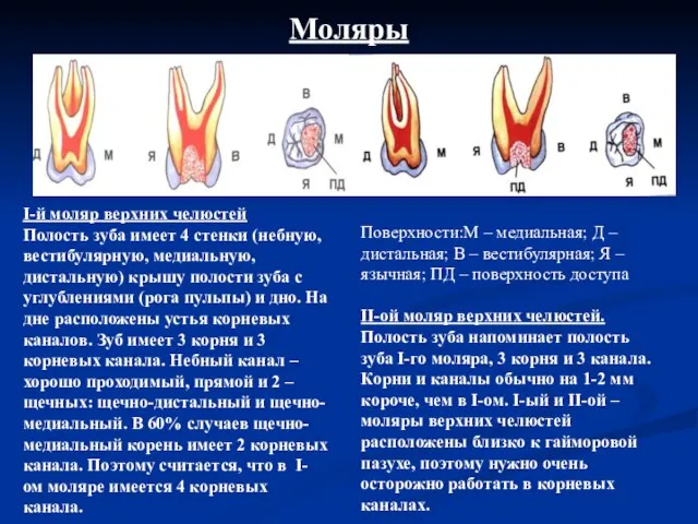 Моляры I-й моляр верхних челюстей Полость зуба имеет 4 стенки (небную, вестибулярную,