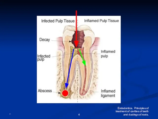 * Endodontics. Principles of treatment of cavities of teeth and ductings of roots.