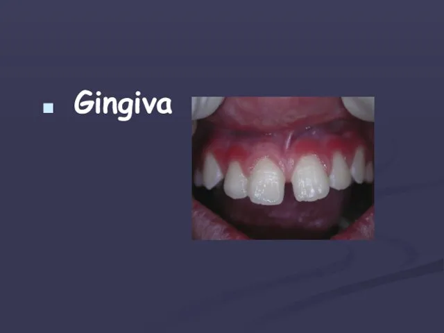 Gingiva