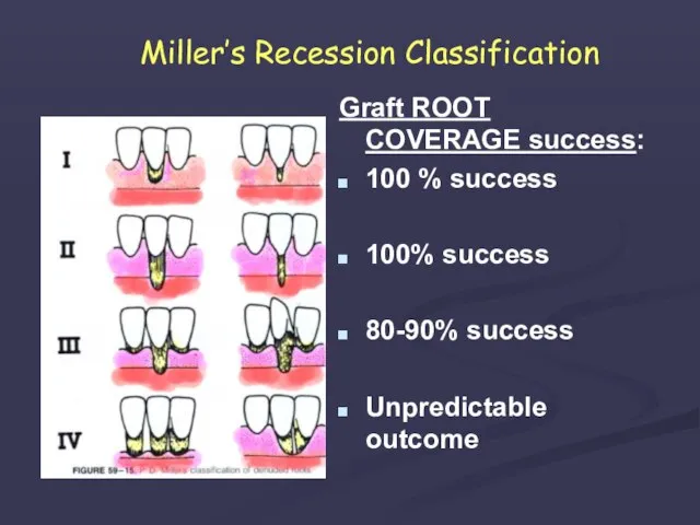 Miller’s Recession Classification Graft ROOT COVERAGE success: 100 % success 100% success 80-90% success Unpredictable outcome