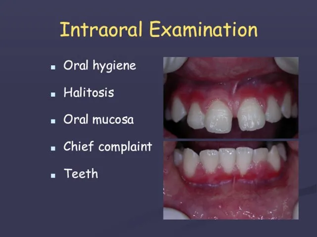 Intraoral Examination Oral hygiene Halitosis Oral mucosa Chief complaint Teeth