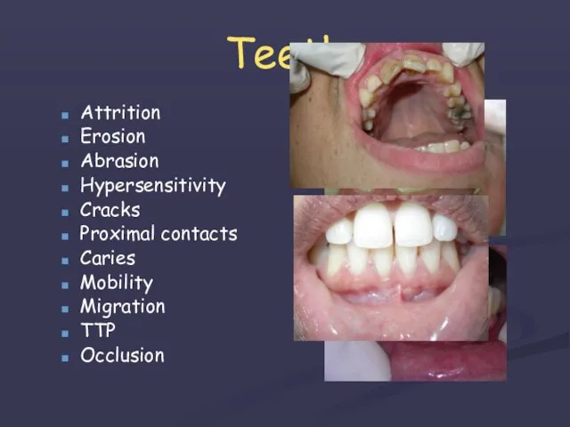 Teeth Attrition Erosion Abrasion Hypersensitivity Cracks Proximal contacts Caries Mobility Migration TTP Occlusion