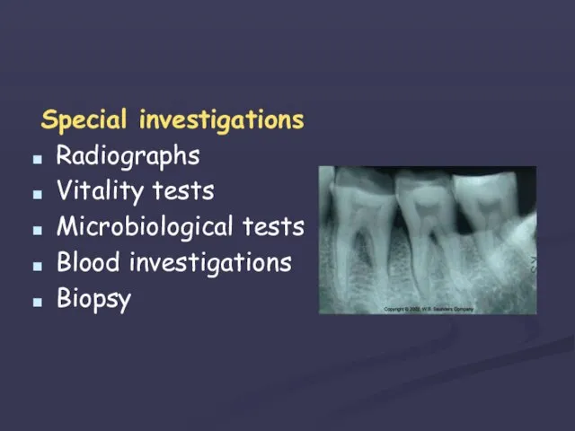 Special investigations Radiographs Vitality tests Microbiological tests Blood investigations Biopsy