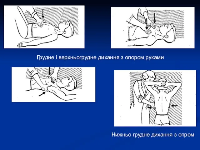 Грудне і верхньогрудне дихання з опором руками Нижньо грудне дихання з опром