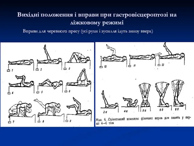 Вихідні положення і вправи при гастровісцероптозі на ліжковому режимі Вправи для черевного