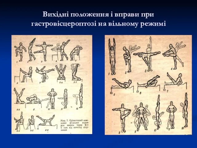 Вихідні положення і вправи при гастровісцероптозі на вільному режимі