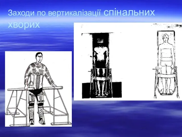 Заходи по вертикалізації спінальних хворих