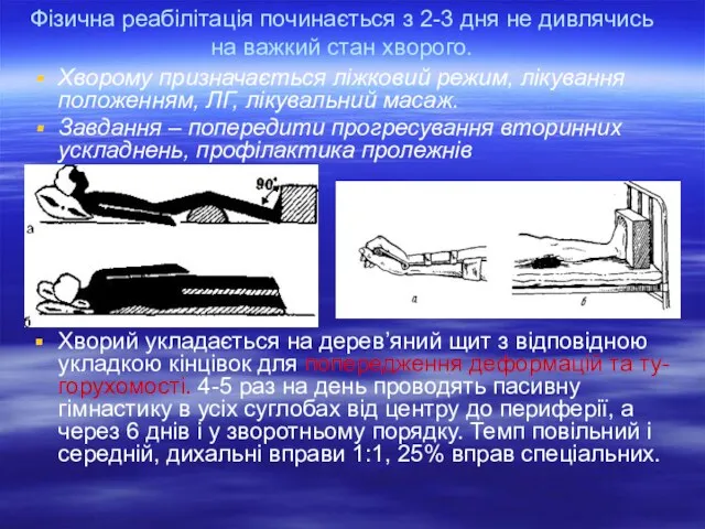 Фізична реабілітація починається з 2-3 дня не дивлячись на важкий стан хворого.