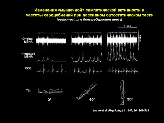 Iwase et al. Physiologist 1987, 30, S62-S63 Изменения «мышечной» симпатической активности и