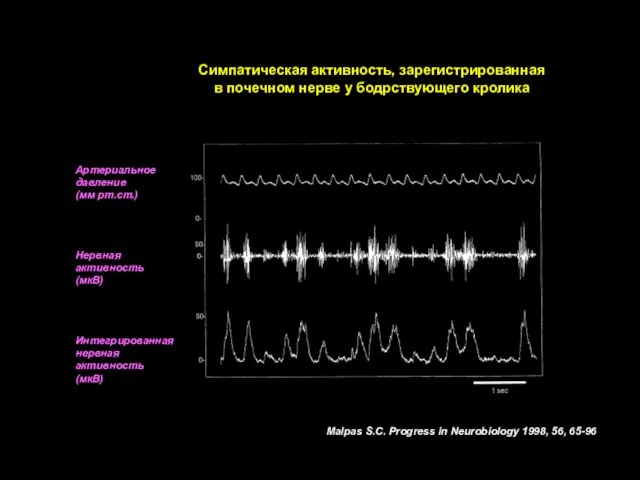 Артериальное давление (мм рт.ст.) Нервная активность (мкВ) Интегрированная нервная активность (мкВ) Симпатическая