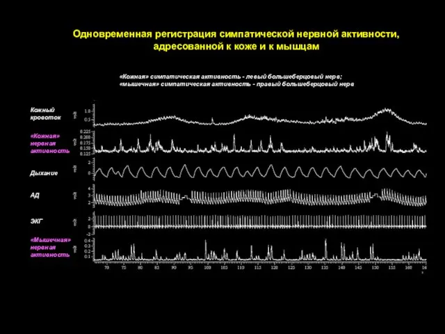 Одновременная регистрация симпатической нервной активности, адресованной к коже и к мышцам «Кожная»