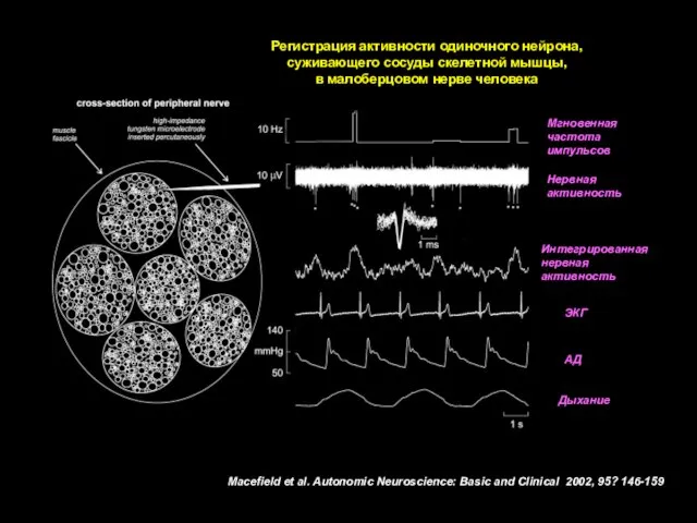 Macefield et al. Autonomic Neuroscience: Basic and Clinical 2002, 95? 146-159 Регистрация