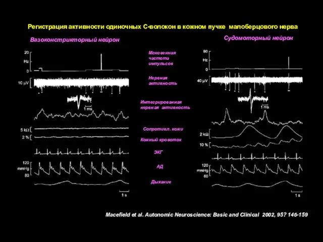 Macefield et al. Autonomic Neuroscience: Basic and Clinical 2002, 95? 146-159 Регистрация