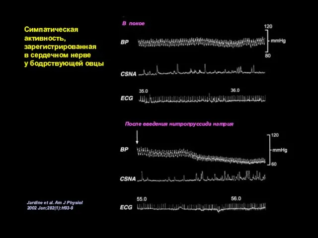 Jardine et al. Am J Physiol 2002 Jan;282(1):H93-9 После введения нитропруссида натрия