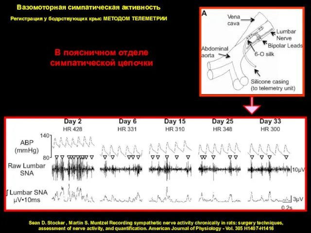 Вазомоторная симпатическая активность Регистрация у бодрствующих крыс МЕТОДОМ ТЕЛЕМЕТРИИ Sean D. Stocker